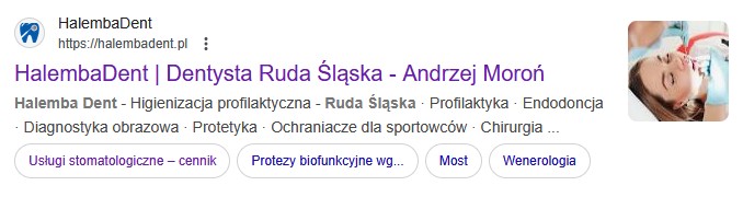 lokalne SEO